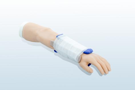 克雷氏骨折处理训练模型