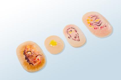  烧  烫 伤评估模块