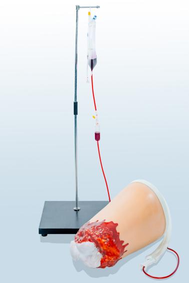  下肢外伤断肢止血模型