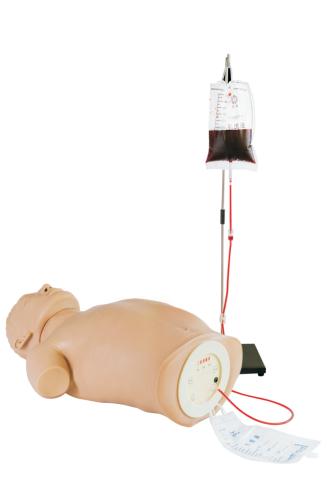 双气囊三腔管止血与十二指肠引流术训练仿生标准化病人