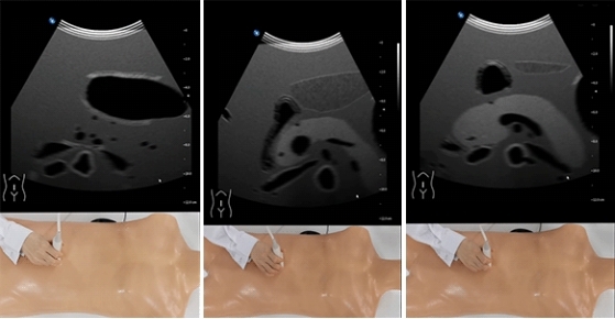 超声模拟实训系统 单机版（男）